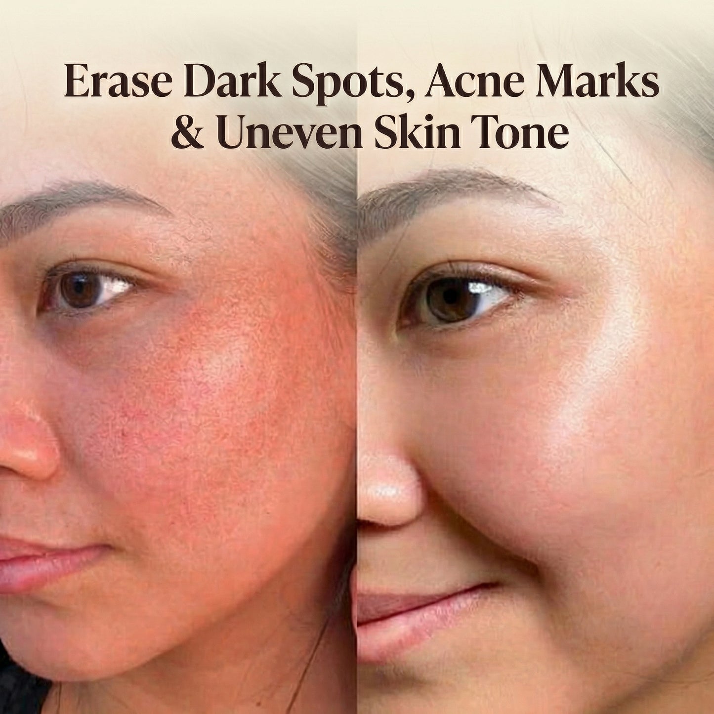 Amirae™ Moroccan Nila Mask